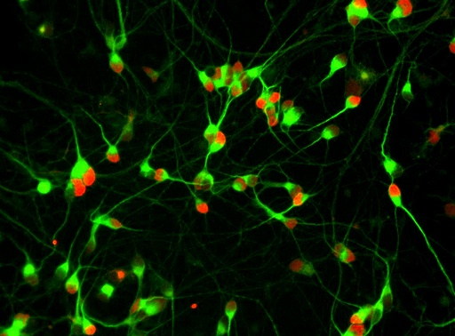 [neuro25sk64] Spinal Motor Neurons